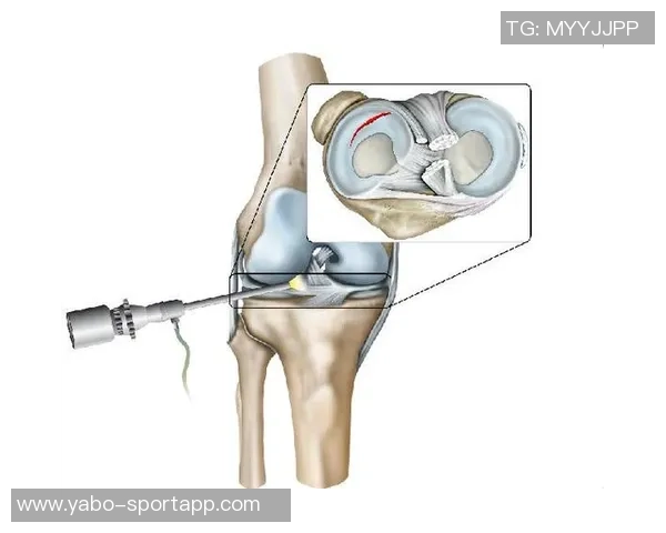 英博官方宣布宋岳成功接受关节镜微创手术恢复顺利无并发症